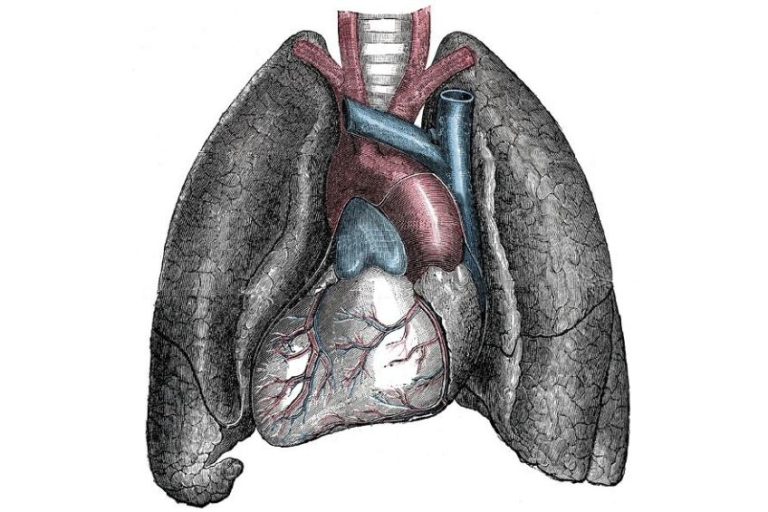 situs inversus